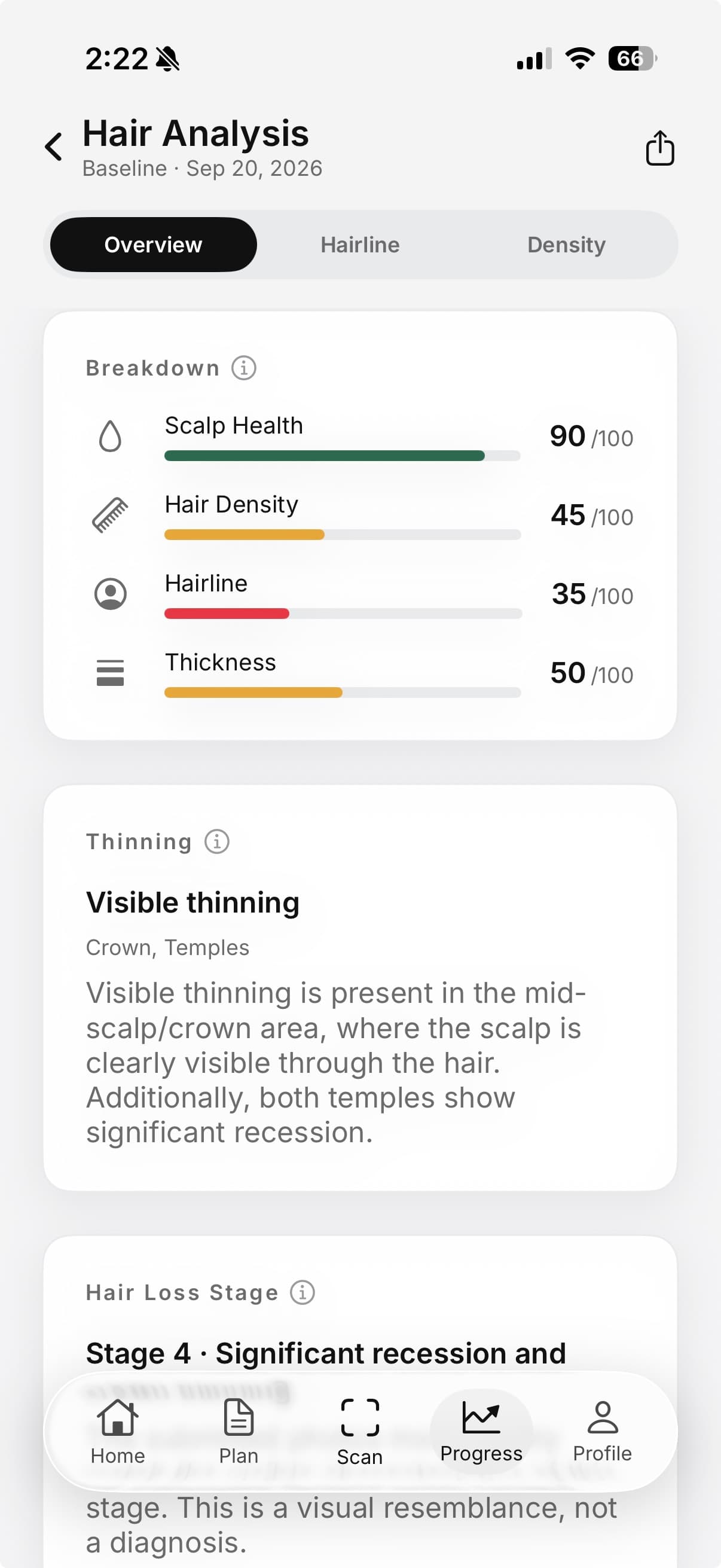 Morph Hair Analysis overview with four dimension scores and visible thinning observations